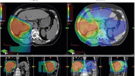 gastrointestinal malignancy