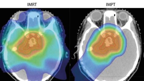 Treating pediatric tumors with proton therapy_whitepaper